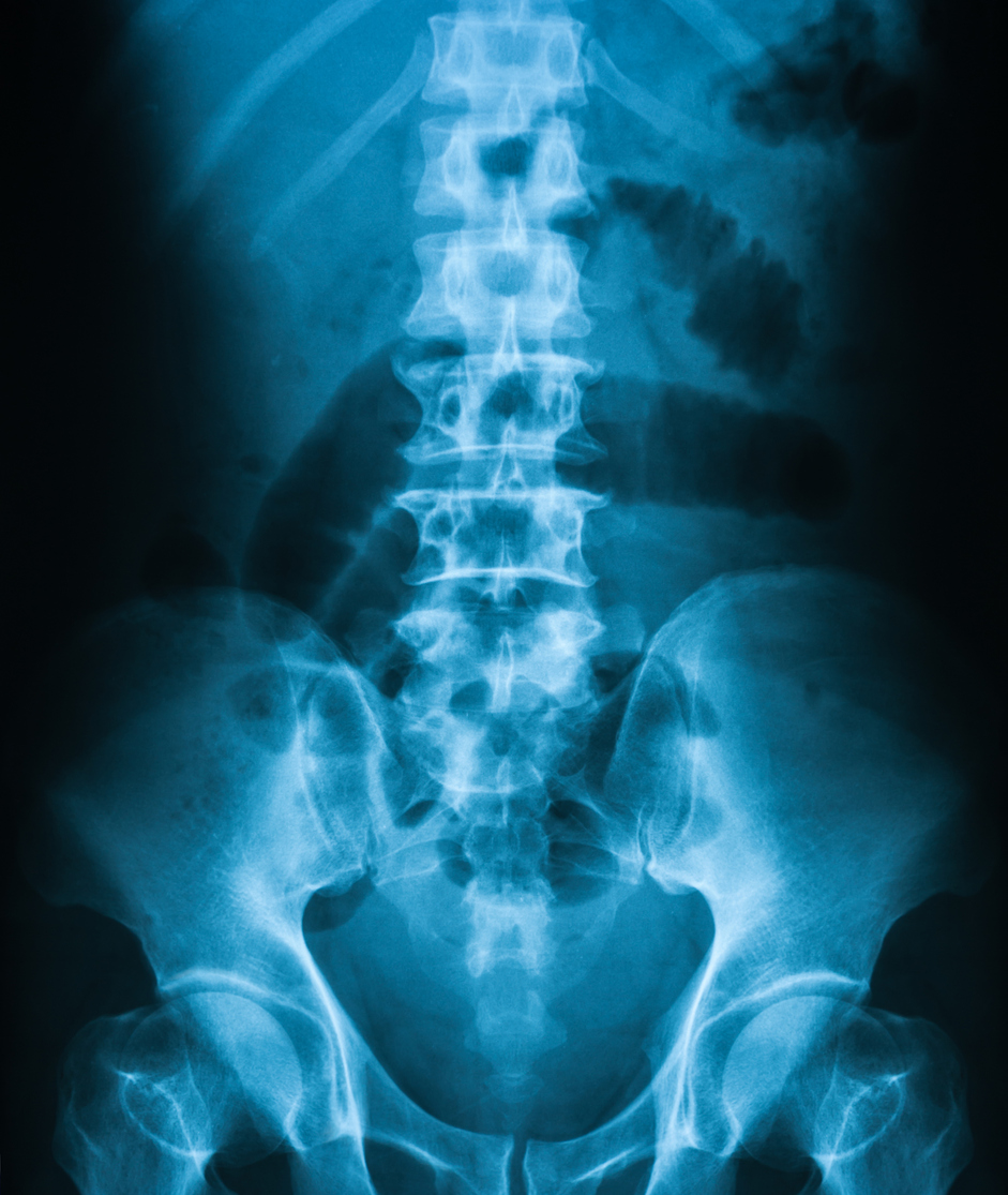 Preparation for an abdominal x-ray ordered by your Provider